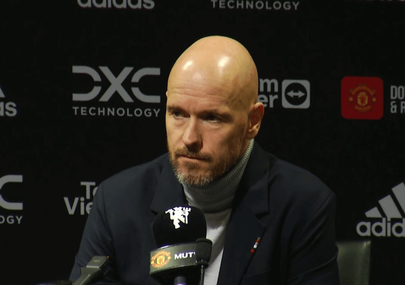 Ten Hag po prehre s Bournemouthom